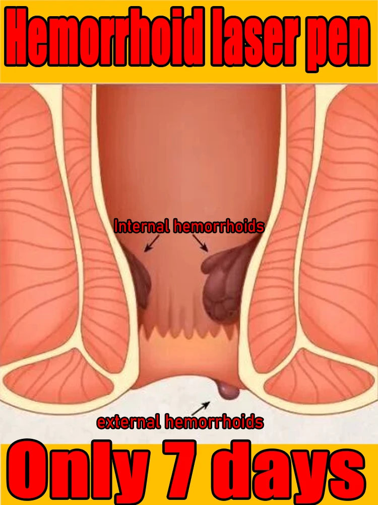 The second generation improves problems such as hemorrhoid leakage and can be used by both men and women.